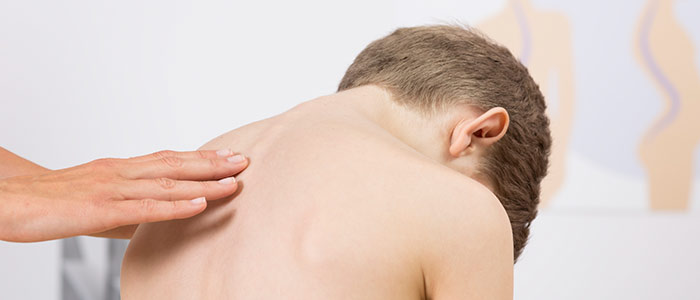 Child being examined for scoliosis on his spine by a doctor