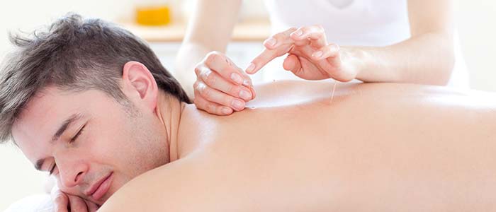 man getting dry needle treatment